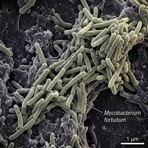 Balık Veremi (Mycobacterium fortuitum) Thumbnail