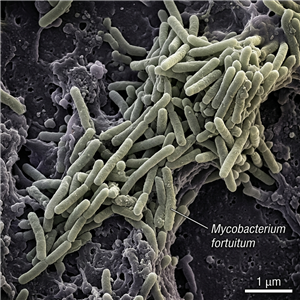 Balık Veremi (Mycobacterium fortuitum) Thumbnail
